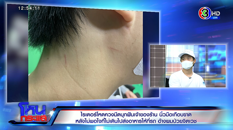 ไรเดอร์แทงเจ้าของร้านอาหาร