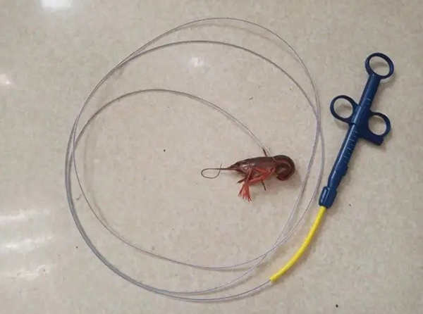 เด็กชายยัดกุ้งใส่รูทวาร