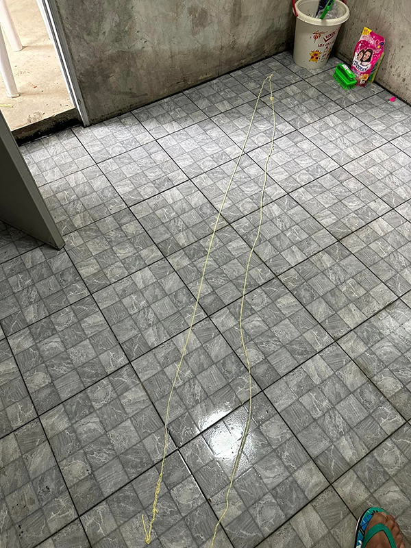 นึกว่าเส้นบะหมี่ ที่แท้พยาธิตืดวัว จากการกินซอยจุ๊