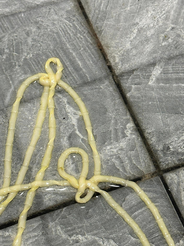 นึกว่าเส้นบะหมี่ ที่แท้พยาธิตืดวัว จากการกินซอยจุ๊