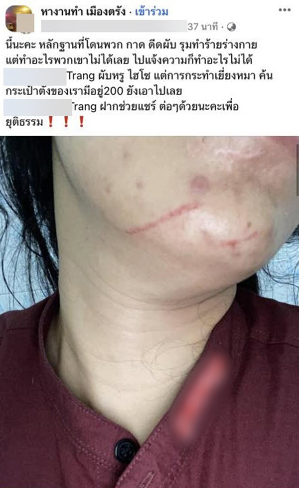 สาวพีอาร์จวกผับดัง ถูกการ์ด 20 คนรุมทำร้าย