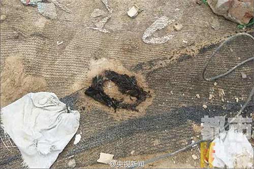 อุทาหรณ์ เด็ก 7 ขวบเกือบตาย เจอไฟดูดสาหัสเพราะฉี่ไม่ดูที่ดูทาง