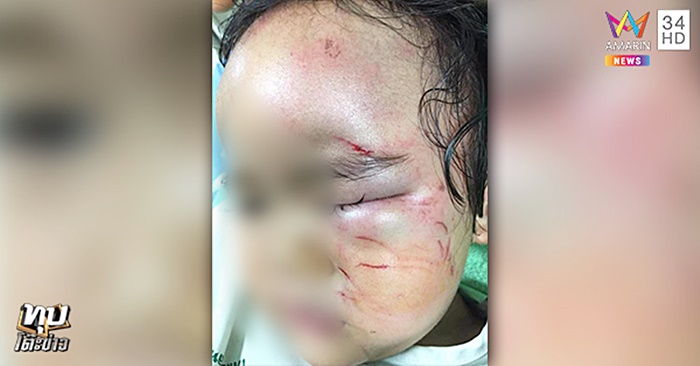 ทำร้ายเด็ก