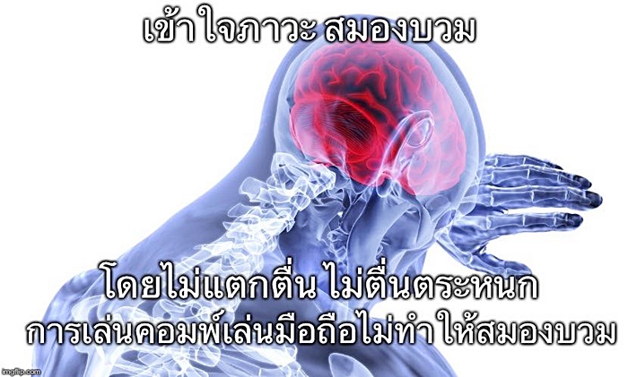 ภาวะสมองบวม