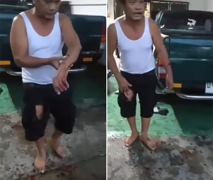 ร็อตไวเลอร์รุมกัดคนอีกแล้ว