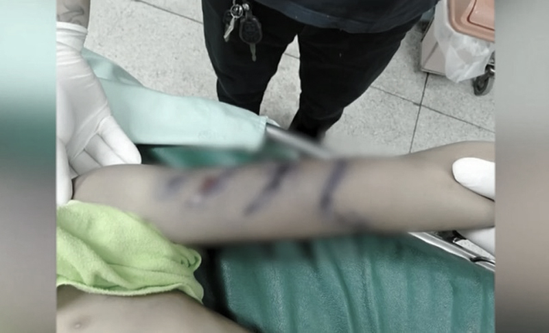 จากใจแม่น้องเหนือโดนพ่อเลี้ยงทำร้ายจนตาย