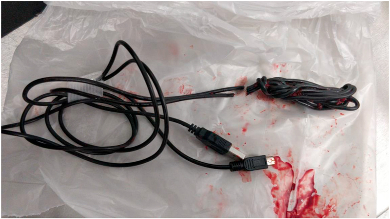 หนุ่มสอดUSBเข้าอวัยวะเพศ