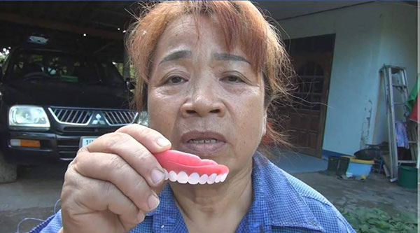 หลอกขายฟันปลอม