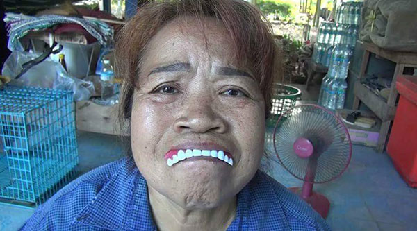 หลอกขายฟันปลอม