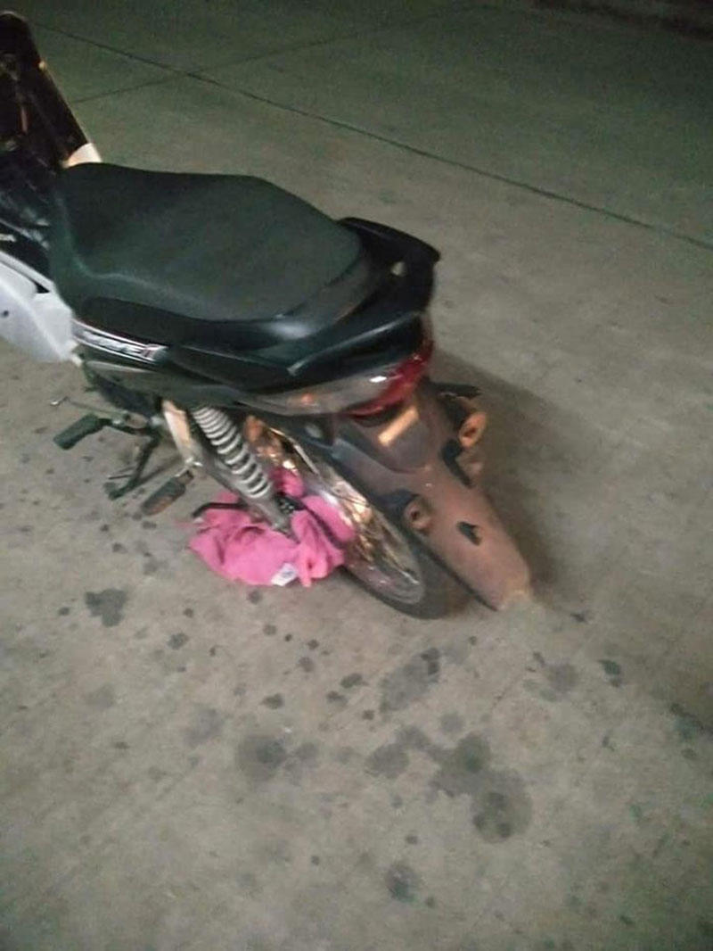 อุบัติเหตุเด็ก