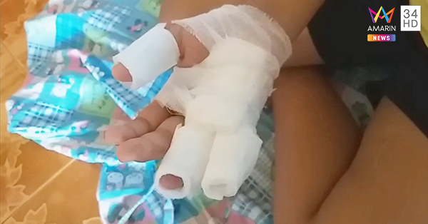 หลอดไฟช็อตมือ