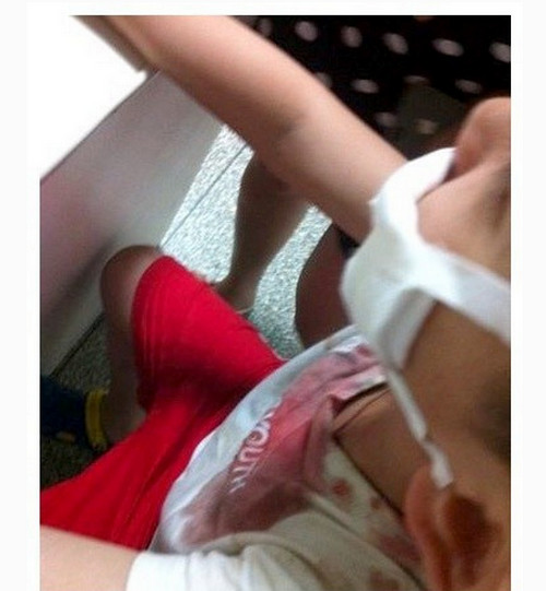 เด็กจีนสุดซวย โค้กกระป๋องระเบิดอัดหน้ายับ เย็บ 38 เข็ม