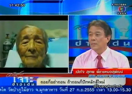 สุเทพ เลาหะวัฒนะ พี่ หมอสุพัฒน์ เลาหะวัฒนะ