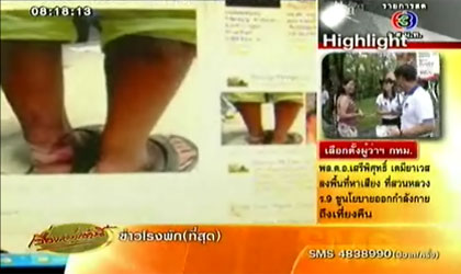 เด็กกะเหรี่ยงถูกทรมาน