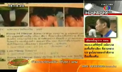 เด็กกะเหรี่ยงถูกทรมาน