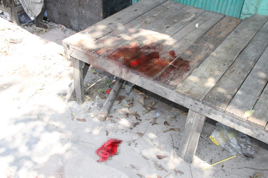 หนุ่มเมาคว้ามีดโกนขลิบเจ้าโลกพลาด เลือดพุ่ง โร่ส่งหมอเย็บ