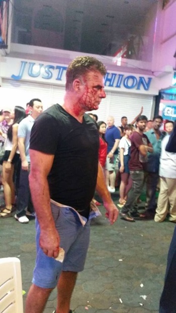 กะเทยทำร้ายฝรั่ง