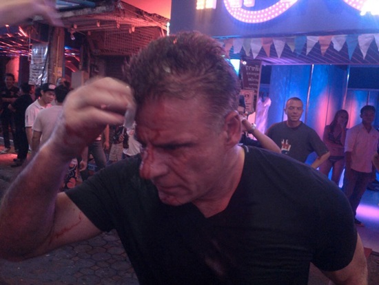 กะเทยทำร้ายฝรั่ง