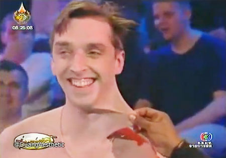 มนุษย์ยืดผิวหนังได้มากที่สุดในโลก