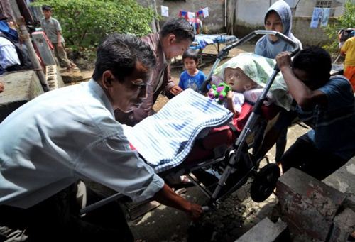 หนูน้อยอินโดป่วยแปลก หัวโตกว่าผู้ใหญ่ 3 เท่า