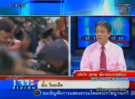 สุเทพ เลาหะวัฒนะ พี่ หมอสุพัฒน์ เลาหะวัฒนะ