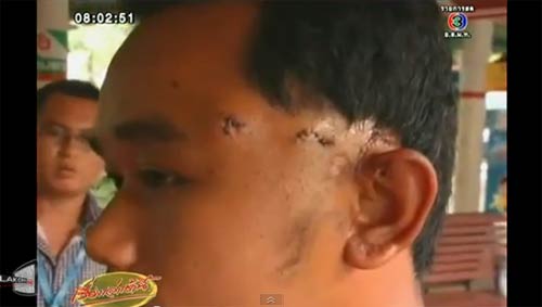 จระเข้งับหัวนักแสดง