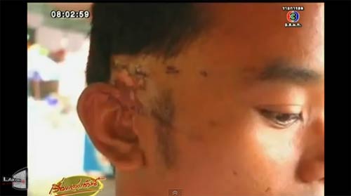 จระเข้งับหัวนักแสดง 