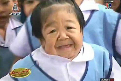 แพทย์รุดตรวจ น้องเจนนี่ เด็กหญิงป่วยโรคหน้าแก่ ชี้ไม่พบโรคแทรก