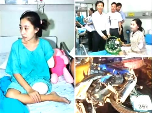 ภรรยาแขนขาขาดขณะตั้งท้อง