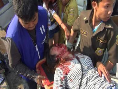 วอนช่วย นักศึกษาสาวบาดเจ็บสาหัส จากเหตุรถตู้โดยสารซิ่งชนรถบัส