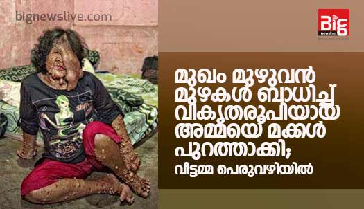 สาวอินโดนีเซียป่วยท้าวแสนปม ถูกไล่จากหมู่บ้าน หลังครอบครัวทิ้ง 