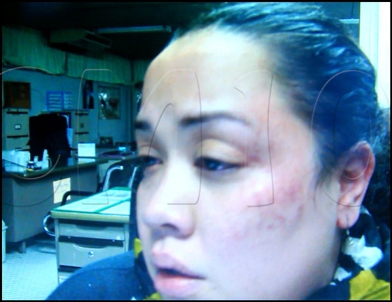 ลานนา คัมมินส์ โดนร้องเพลงไว้ใจได้กาล้อเลียน-ถูกชกหน้าผับเชียงใหม่