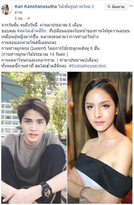 น้องกาญจน์ สาวประเภทสอง