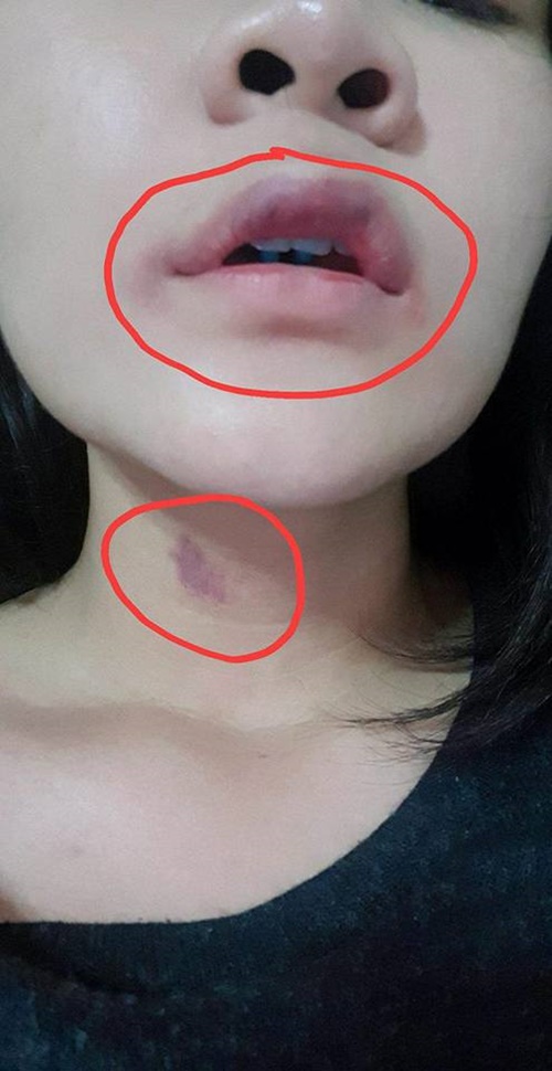 แท็กซี่หื่นกามบังคับอมนกเขา