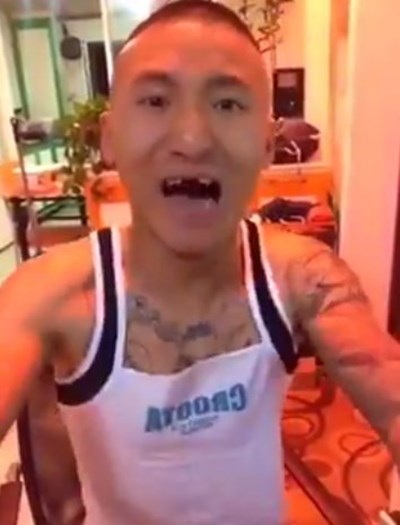 โชว์กินข้าวโพดด้วยสว่าน ทำฟันหน้าหลุดกระเด็น