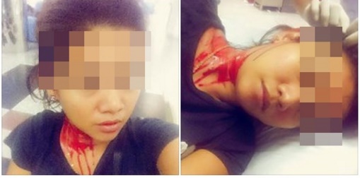  สาวโวยตำรวจปาไฟฉายใส่จนหัวแตก