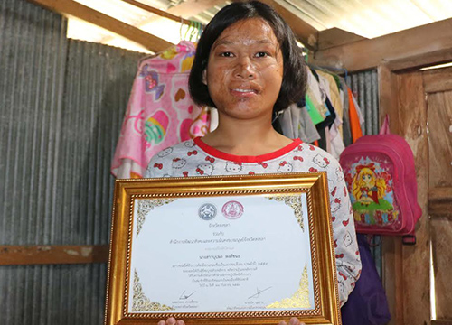 น้องฝน คนไข้ถูกน้ำมันลวกหน้า