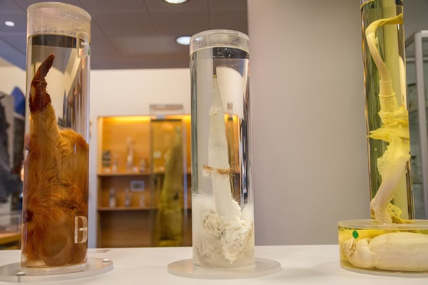 พิพิธภัณฑ์กระปู๋ที่ใหญ่ที่สุดในโลก