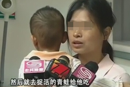 เด็ก 3 ขวบพยาธิเต็มท้อง