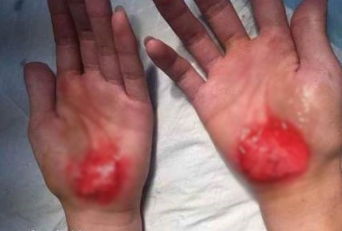 คุณครูสั่งลงโทษให้ใช้มือเดินแทนเท้า