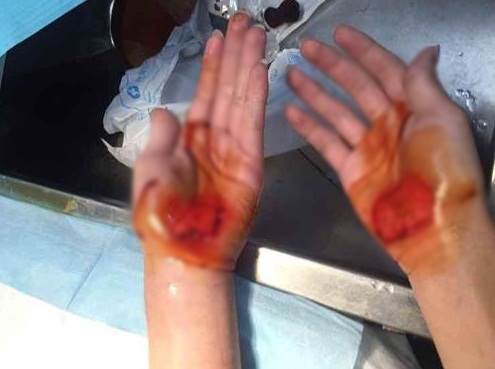 คุณครูสั่งลงโทษให้ใช้มือเดินแทนเท้า