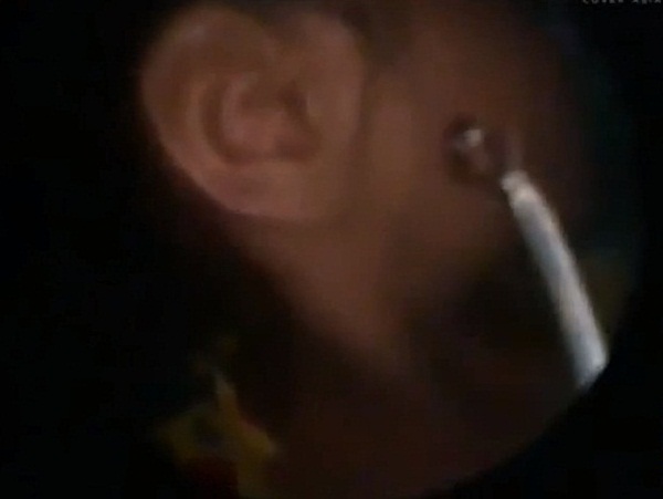 มดทำรังในหูเด็กหญิง