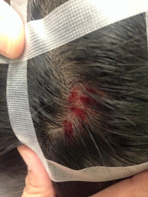 คลิปผู้หญิงโดนผู้ชายต่อยหน้า