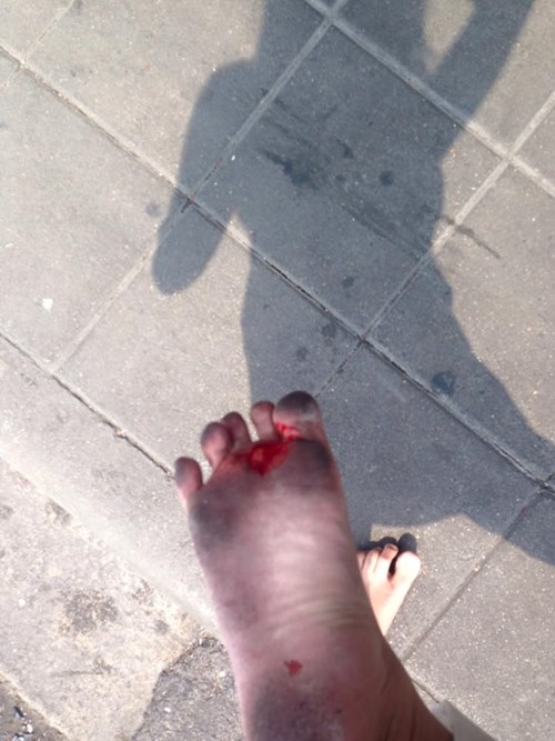 คลิปผู้หญิงโดนผู้ชายต่อยหน้า