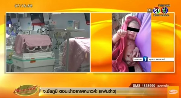 ทารกถูกแทง 14 อาการยังวิกฤต