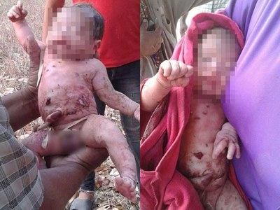 ทารกถูกแทง 14 อาการยังวิกฤต