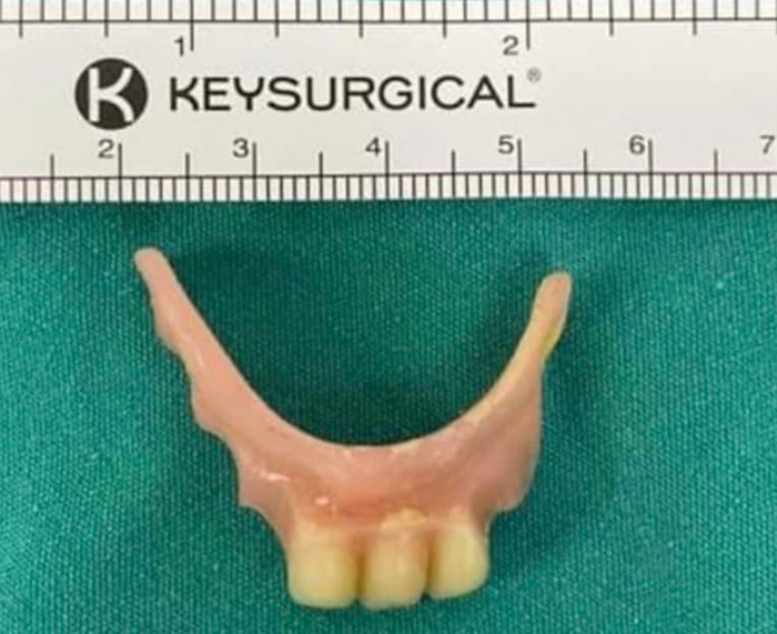 ฟันปลอม