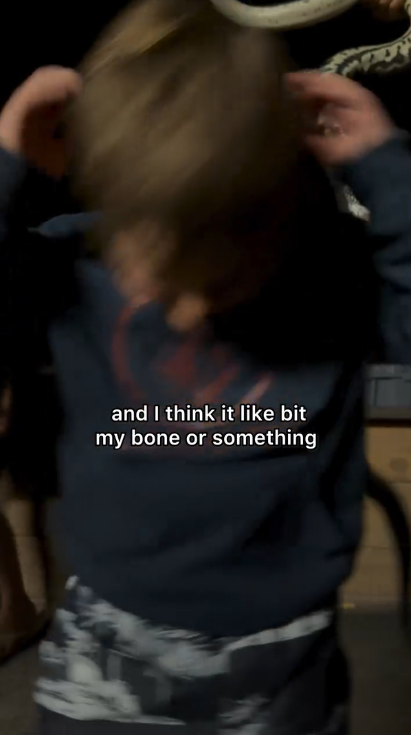 เล่นกับงู งูกัดหัว