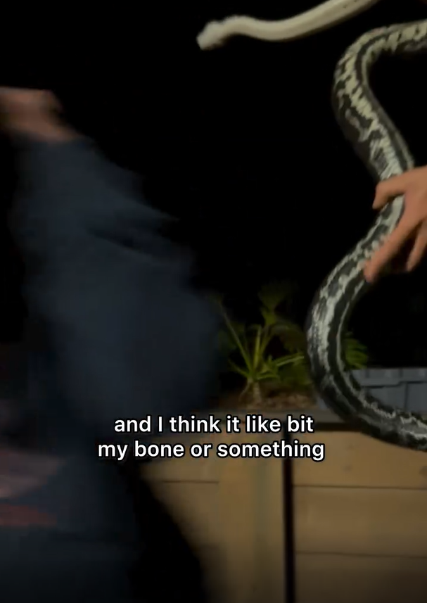 เล่นกับงู งูกัดหัว