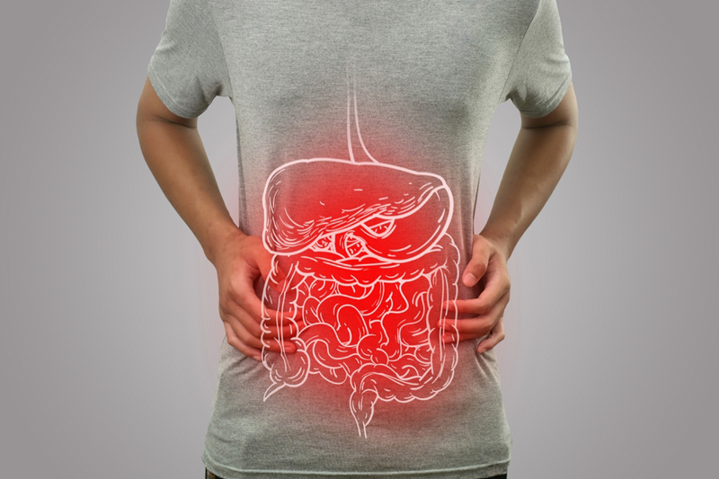 มะเร็งลำไส้